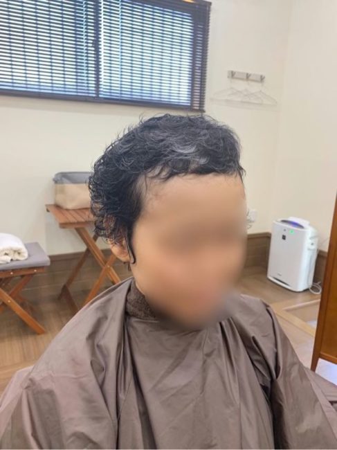 治療後のクルクル癖毛 医療用ウィッグおすすめサロン 治療後のクルクル癖毛 医療用ウィッグおすすめサロン